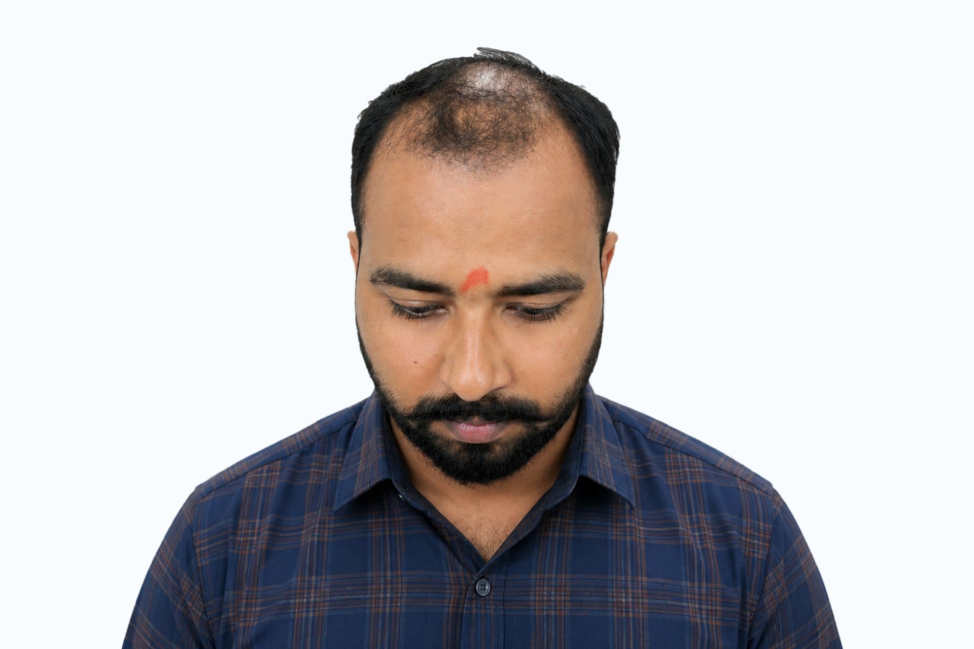 Satya before photo - front