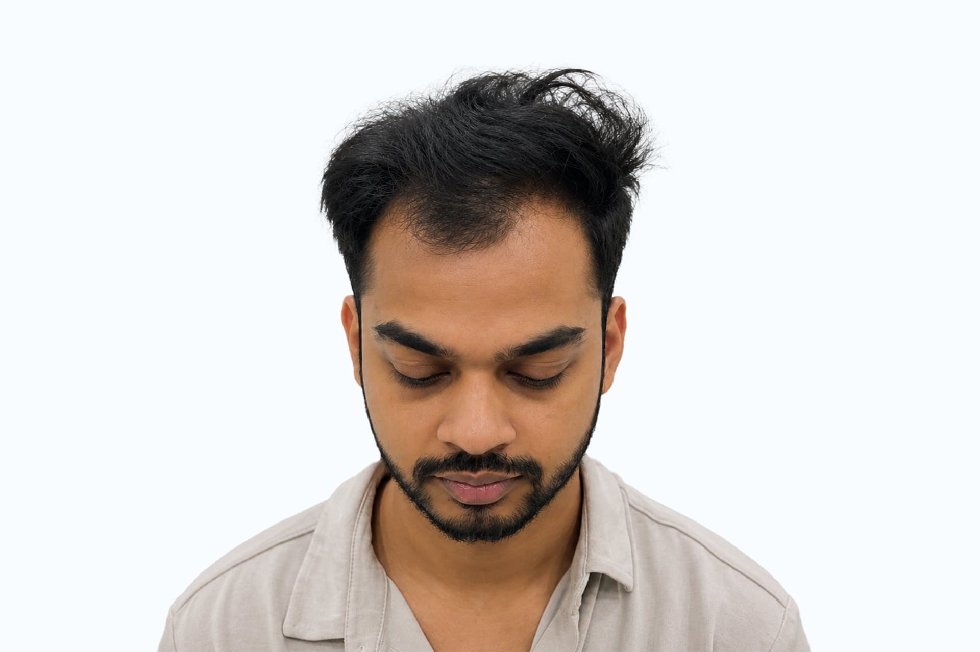 Anshan’s minz before photo - front