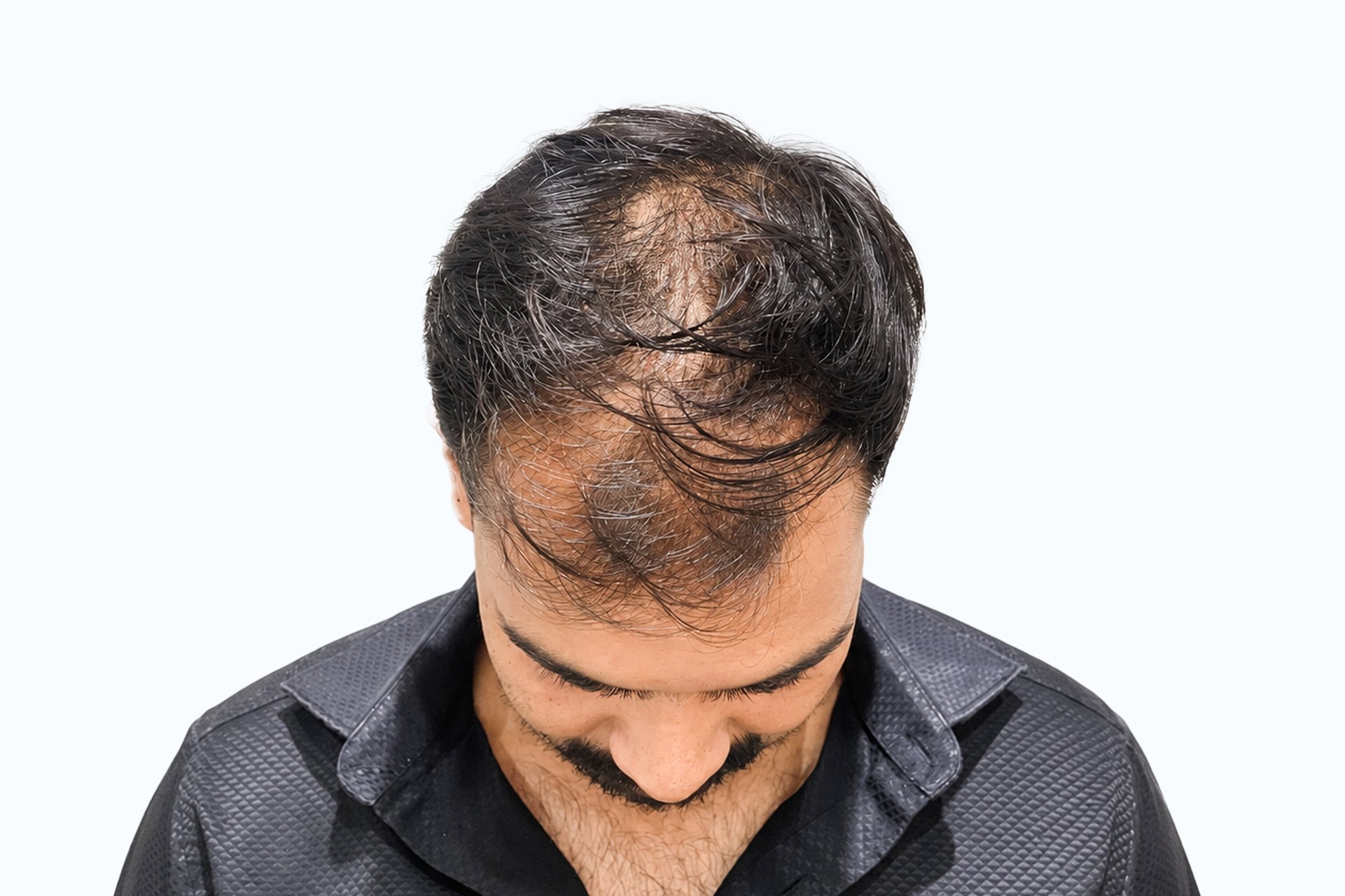 shashikant kumar before photo - front