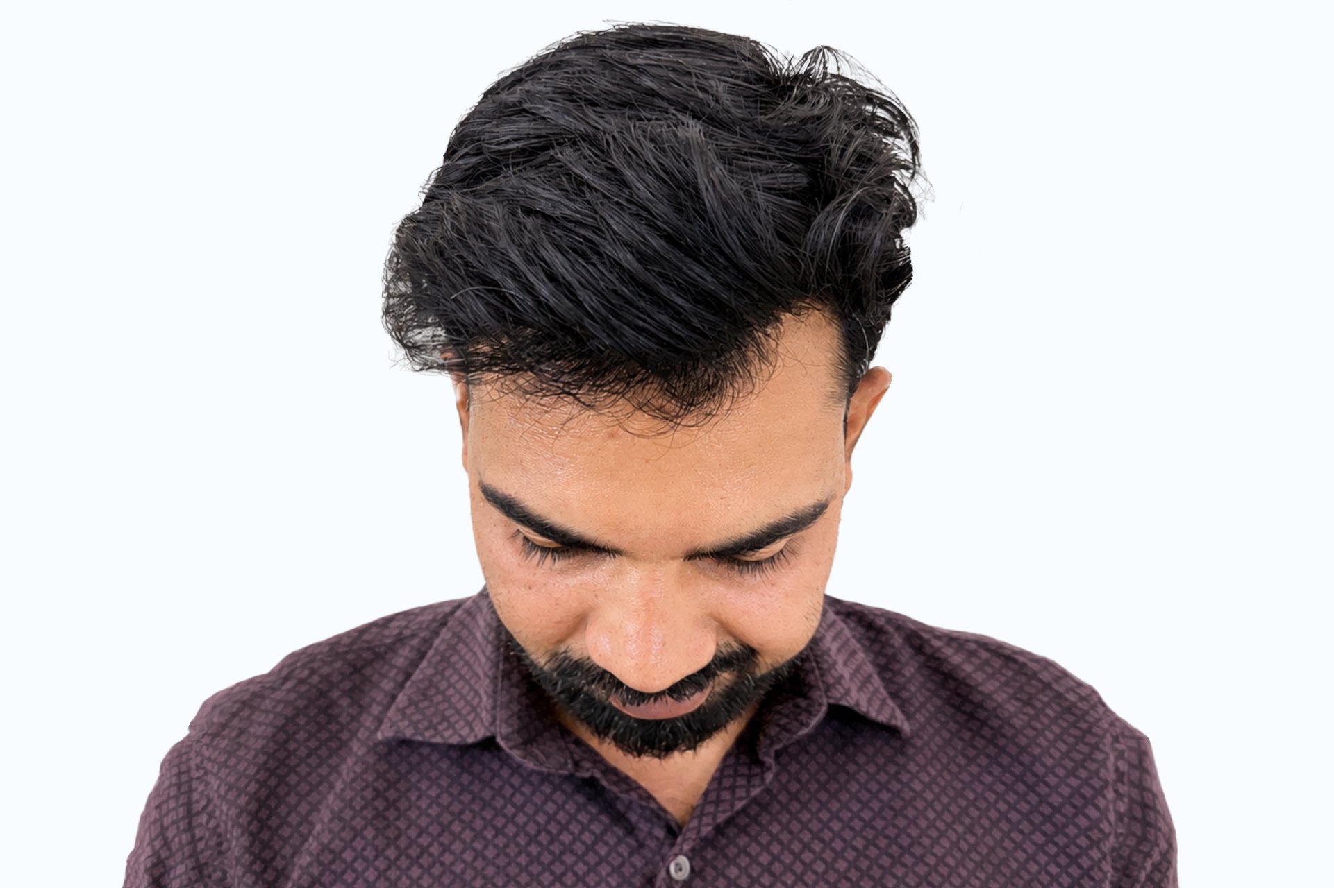 shashikant kumar after photo - front