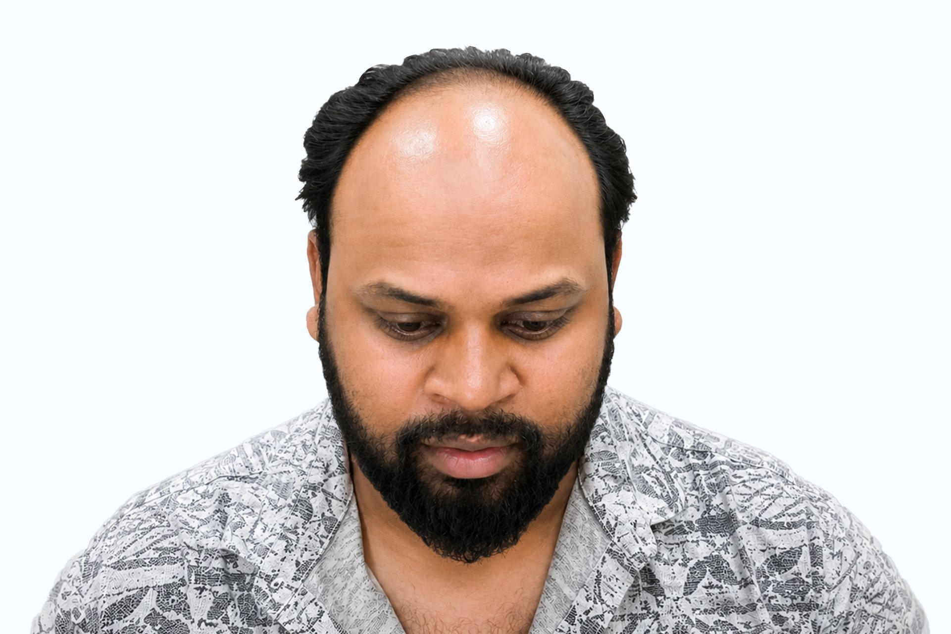 Nishant Kumar before photo - front