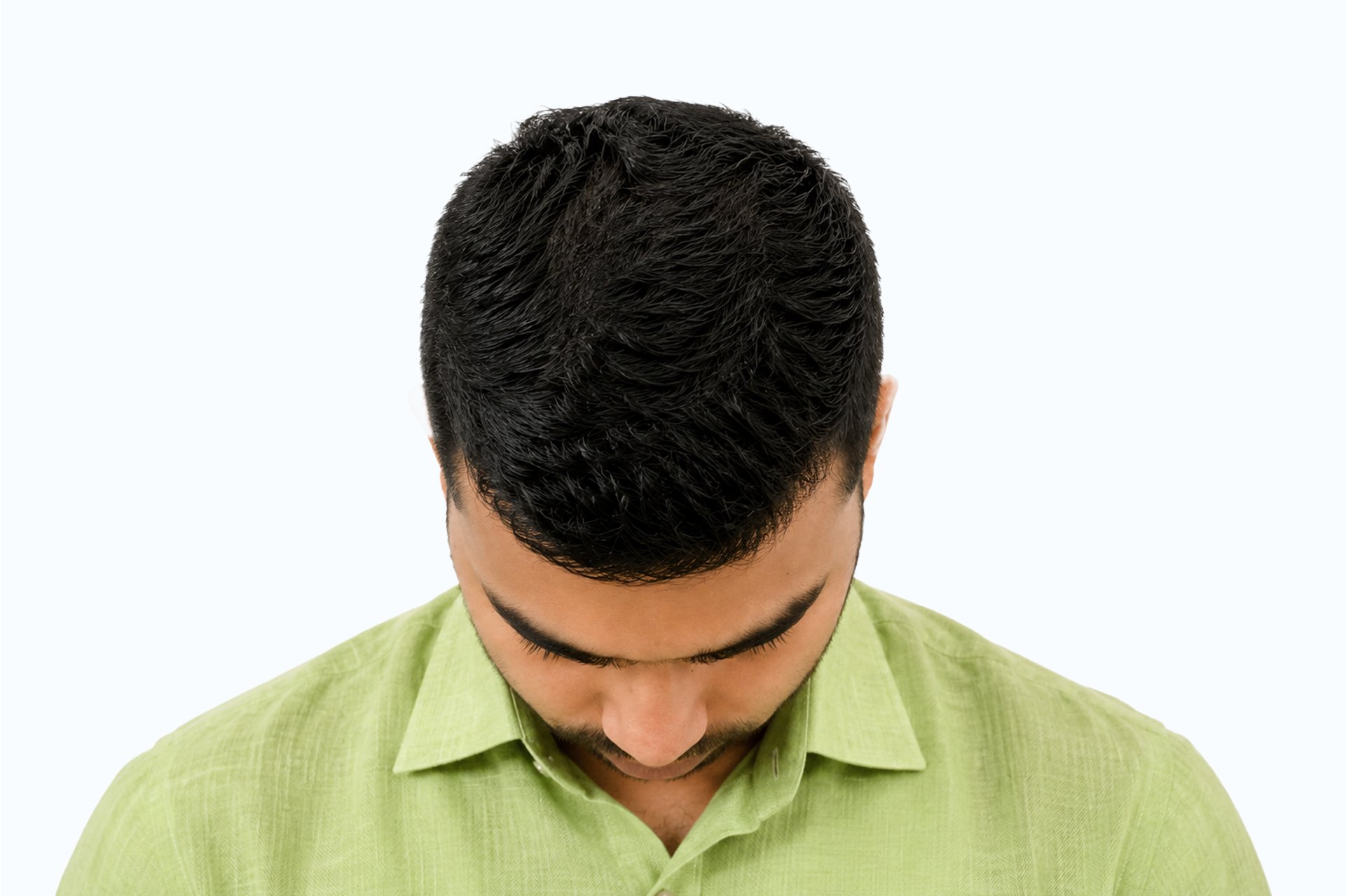 Pankaj Kumar after photo - front