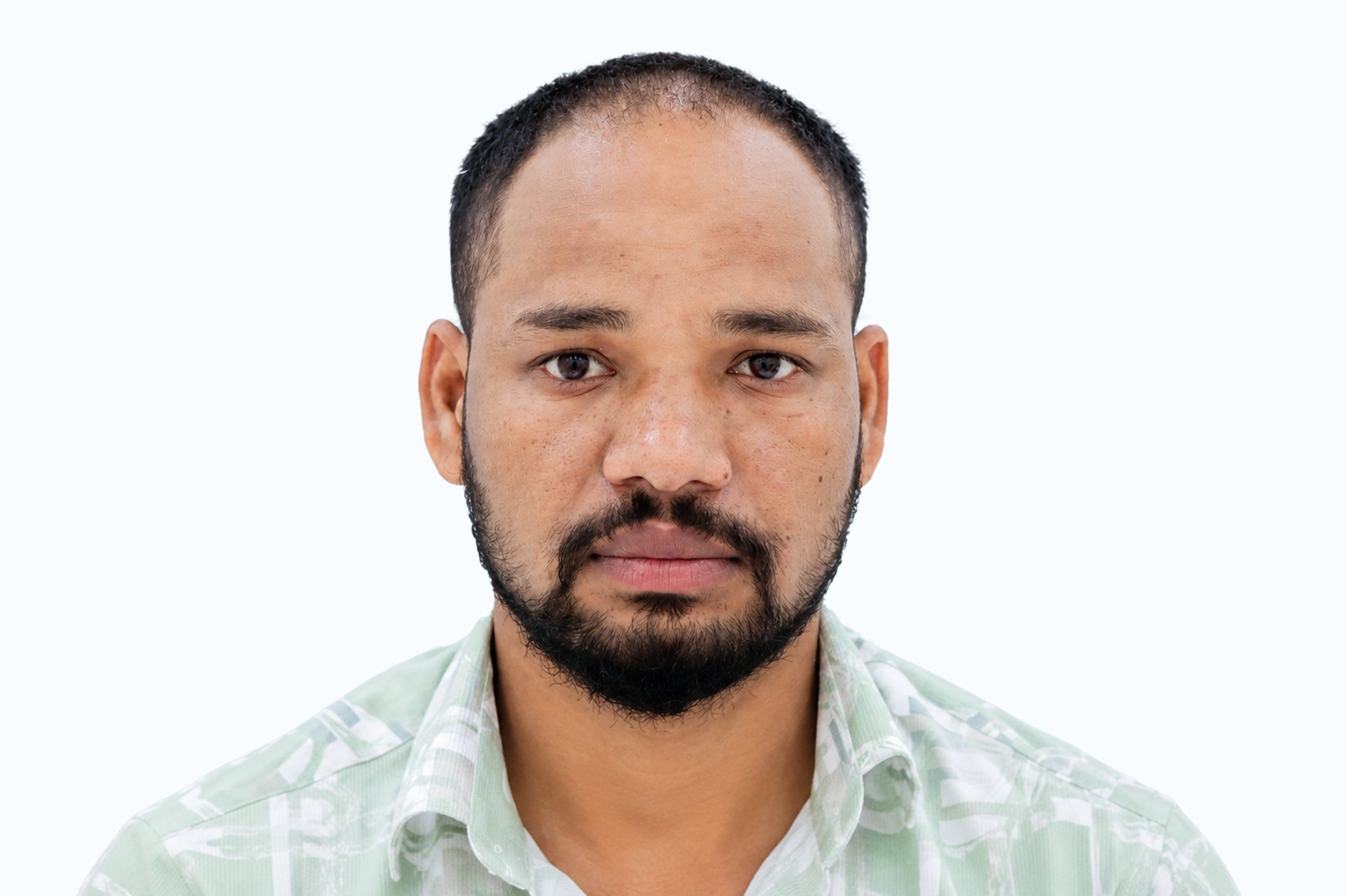 Deepak before photo - front