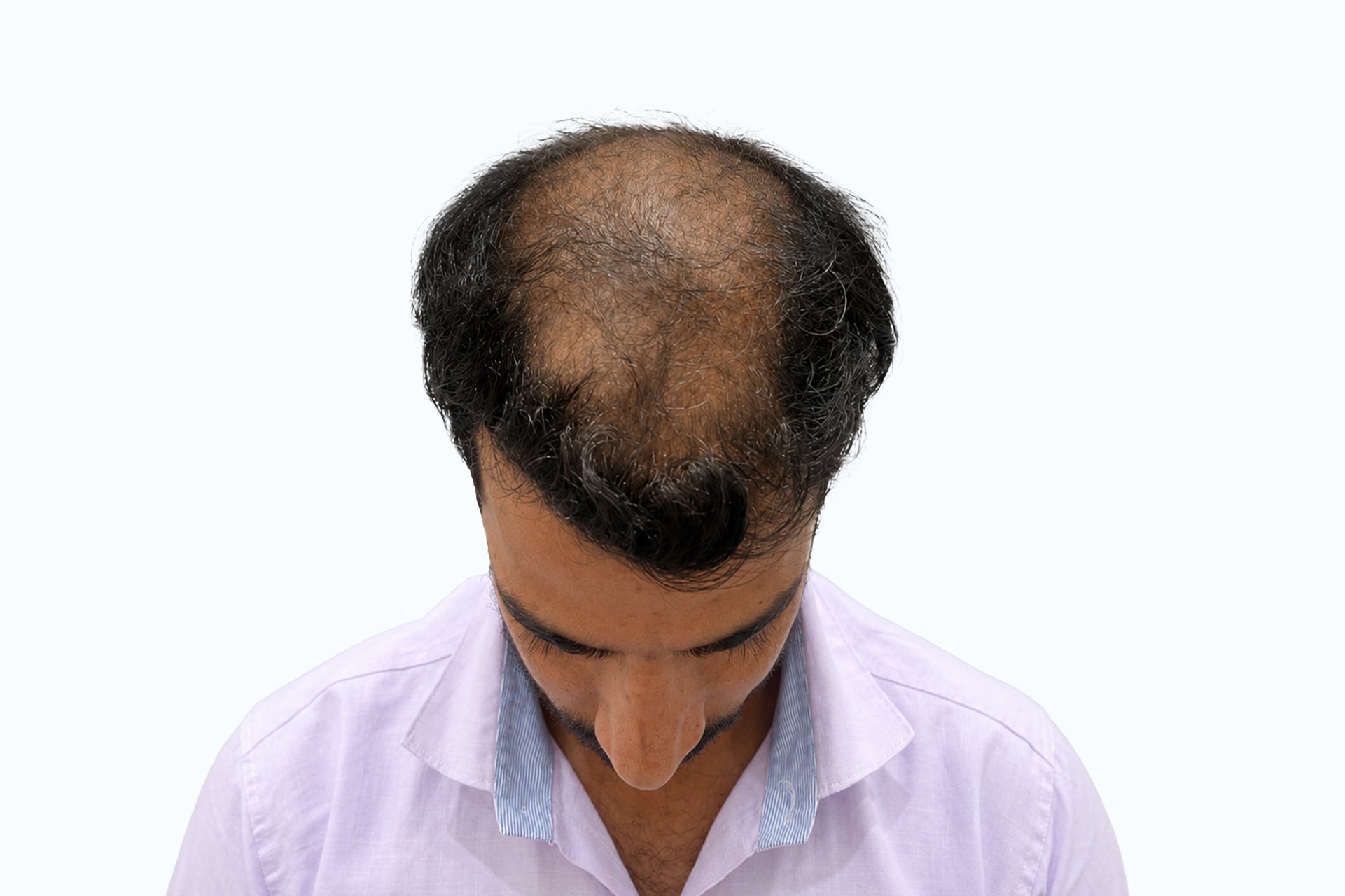 Parwej before photo - front