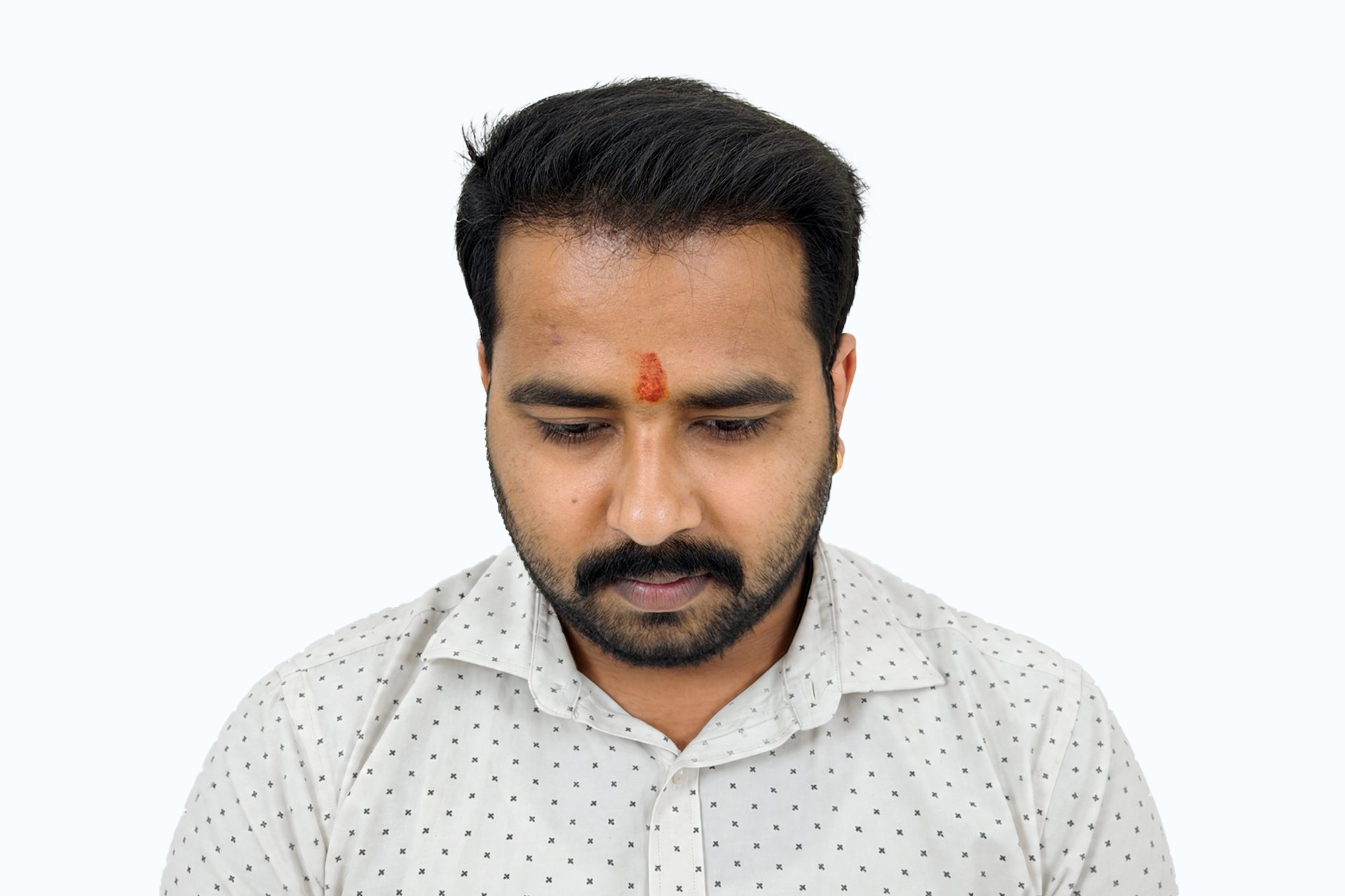 Satya after photo - front