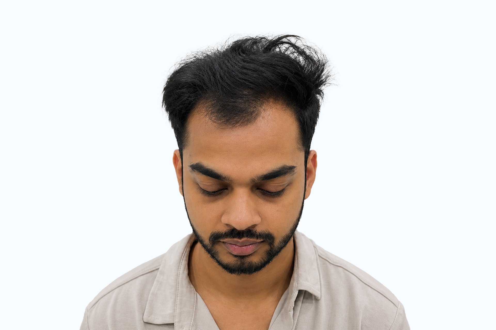 Anshan’s minz before photo - front