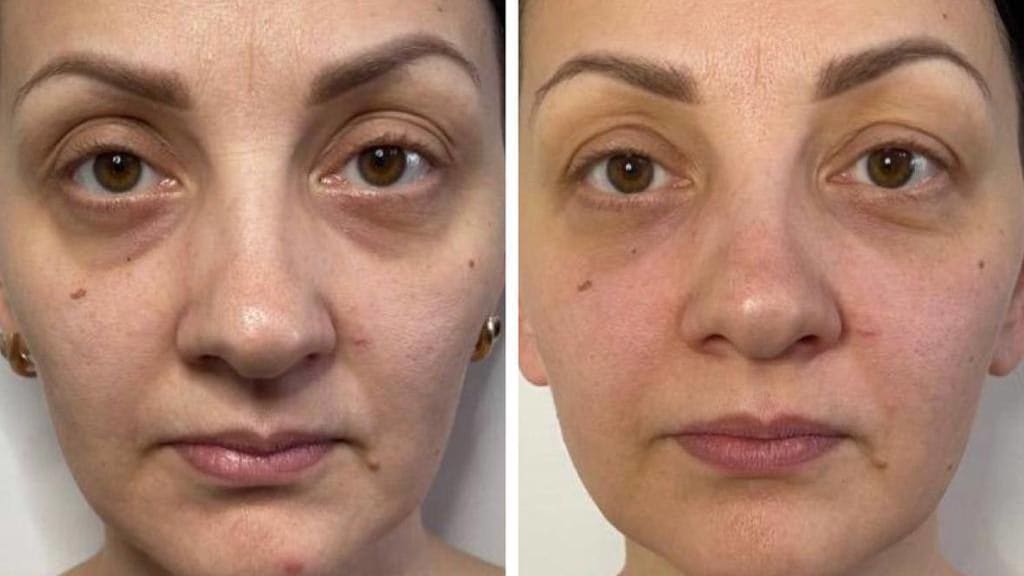 Massaggio facciale: l'alternativa naturale al lifting