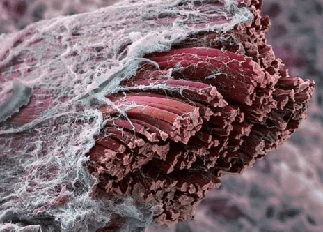 Foto microscopica della fascia 1