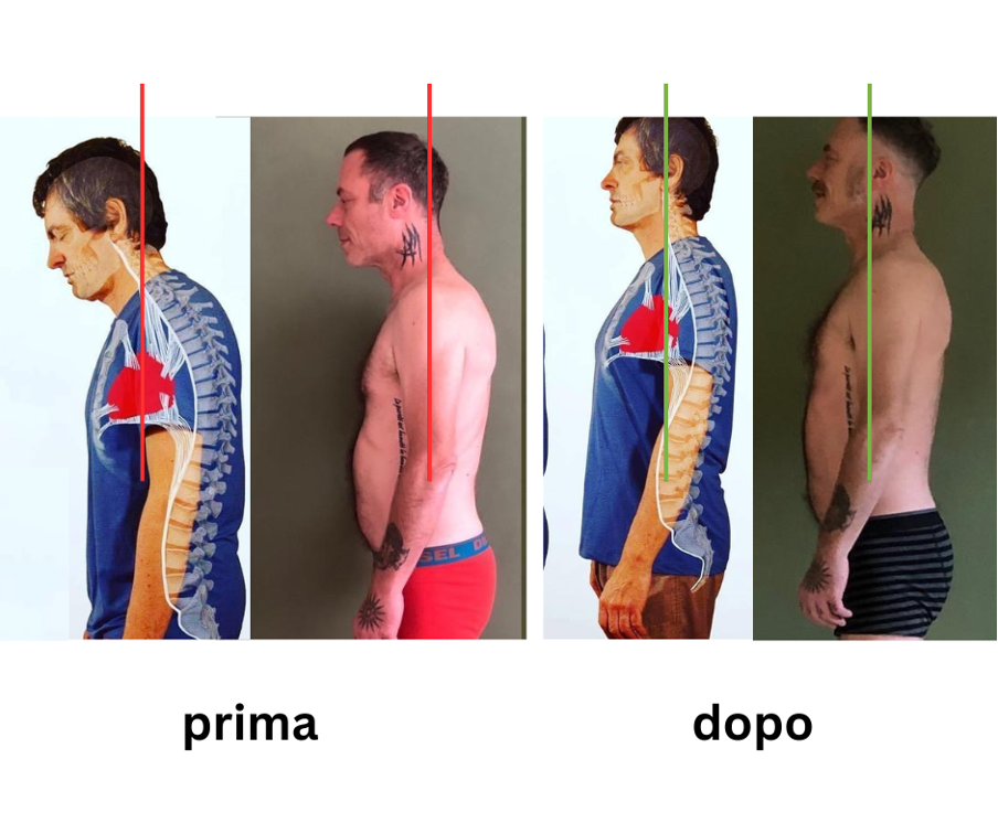 Risultato dopo 10 sessioni: prima e dopo
