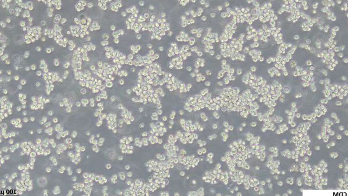 Cancer Research May Go Serum Free Soon