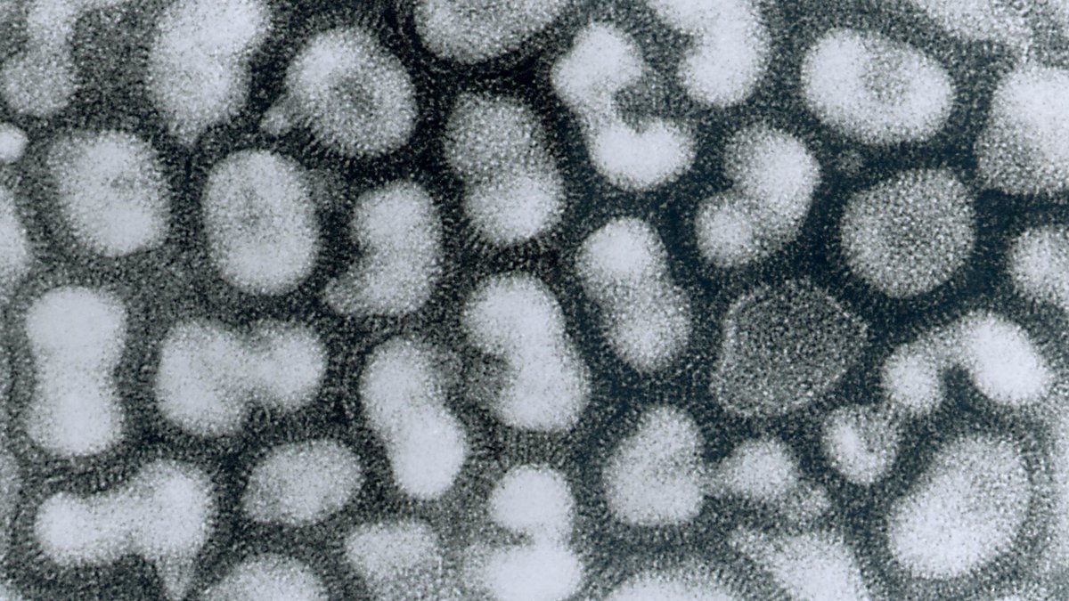Flu in Pregnancy Linked to Overactive Immune Response