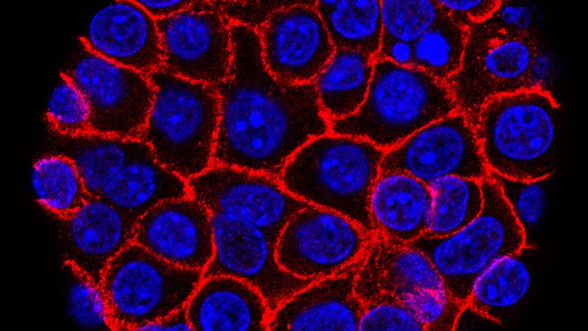 Experimental pill offers hope for deadly pancreatic cancer Experimental pill offers hope for deadly pancreatic cancer - pancreatic cancer treatment