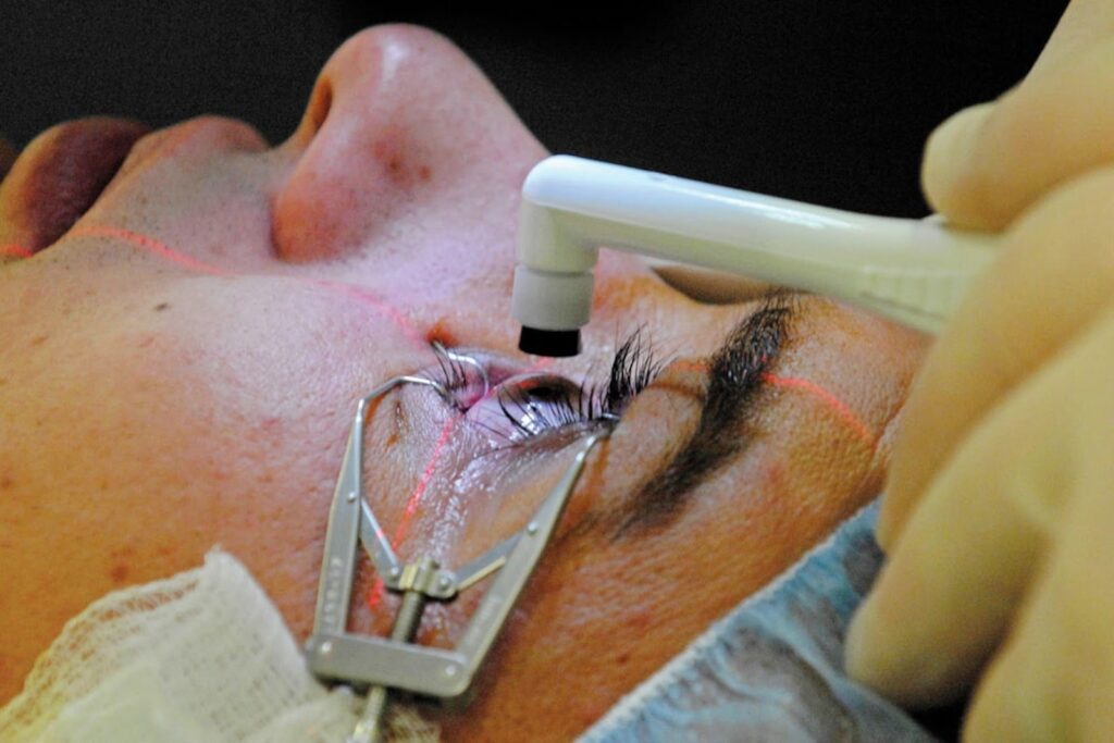 Refractive Surgery Evolution: From LASIK to Tomorrow’s Innovations