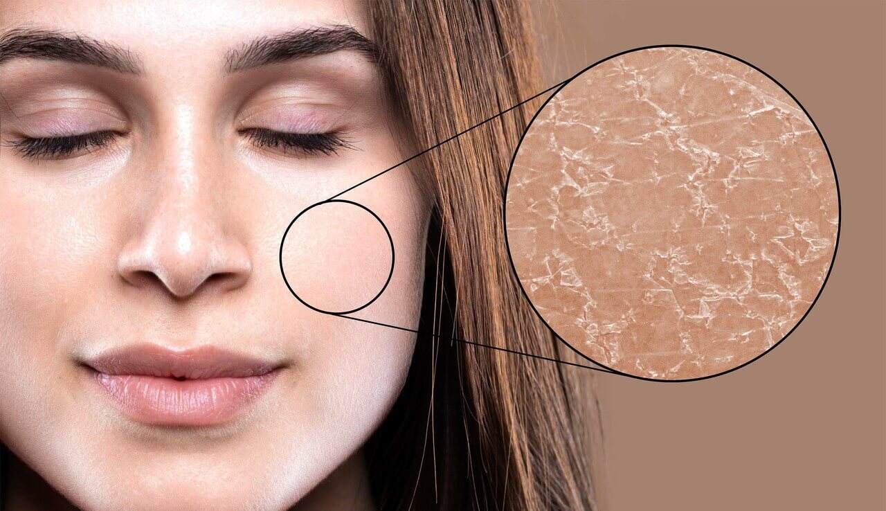 How In-Shower Moisturizers Help Treat Dry Skin?