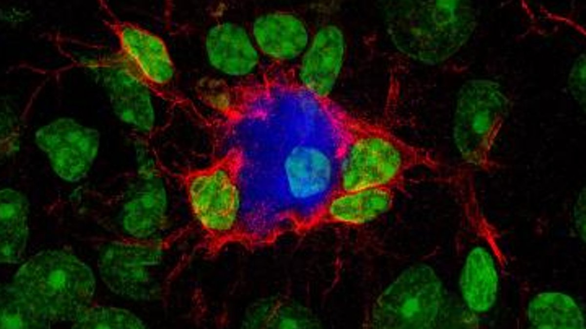 Molecule may reverse brain’s Alzheimer’s defenses Molecule may reverse brain’s Alzheimer’s defenses - reverse alzheimers