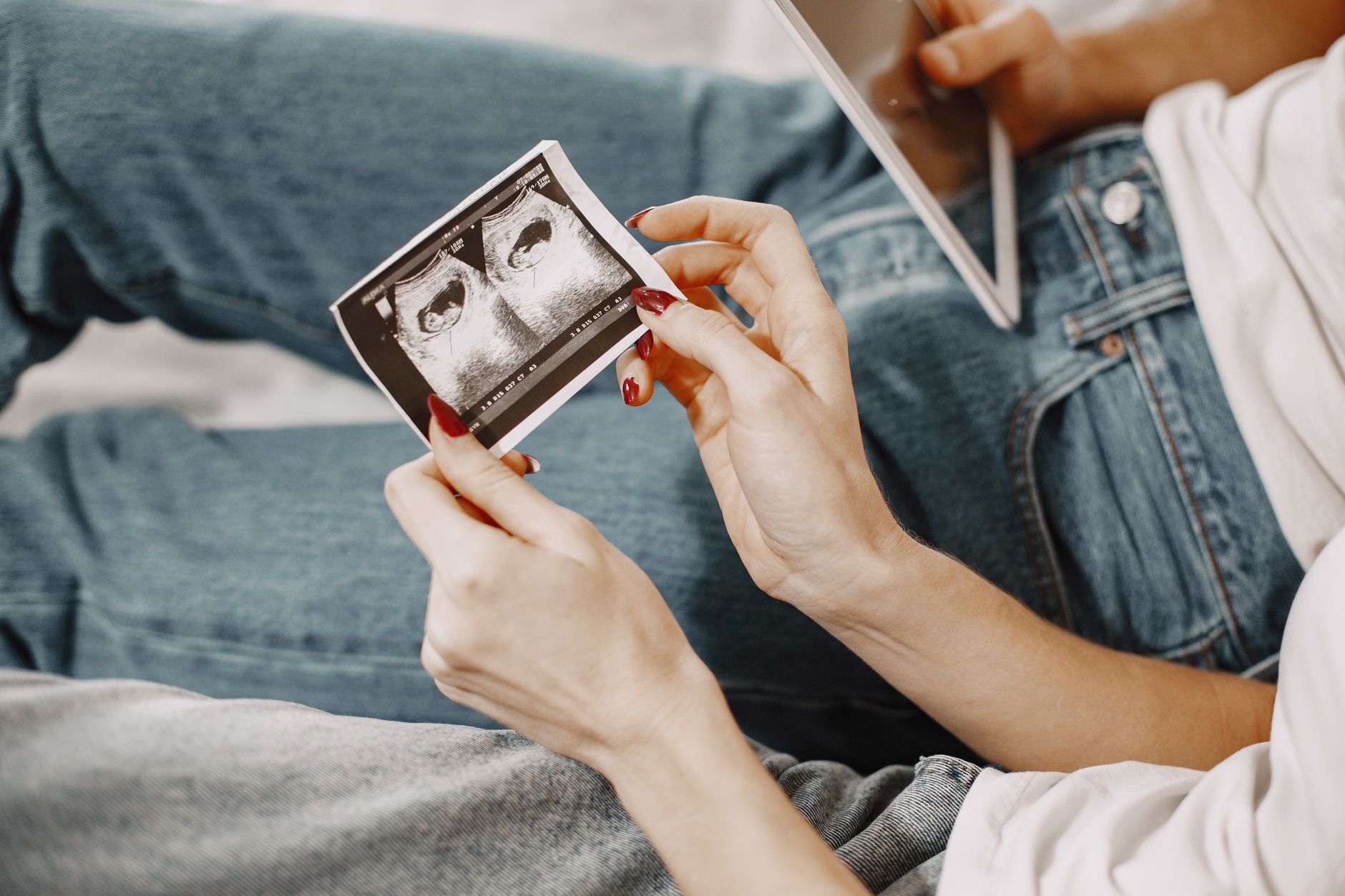 Major Reasons Why You Need a Surrogacy Agency