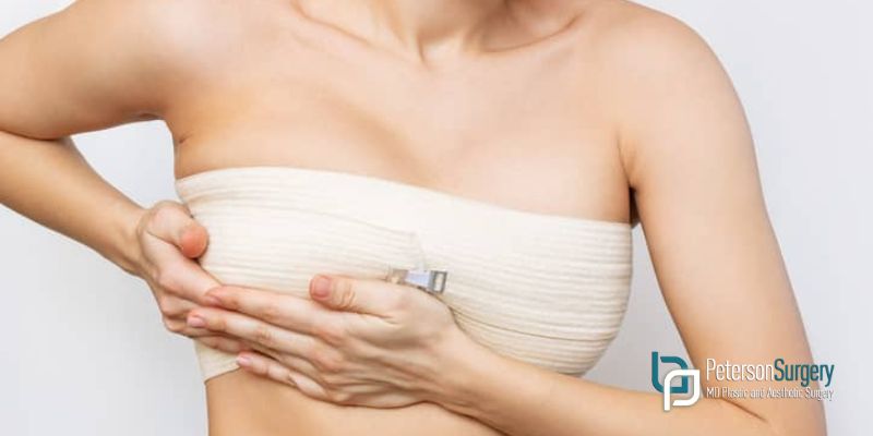 5 Tips That Can Help to Boost Your Recovery After the Breast Lift Procedure