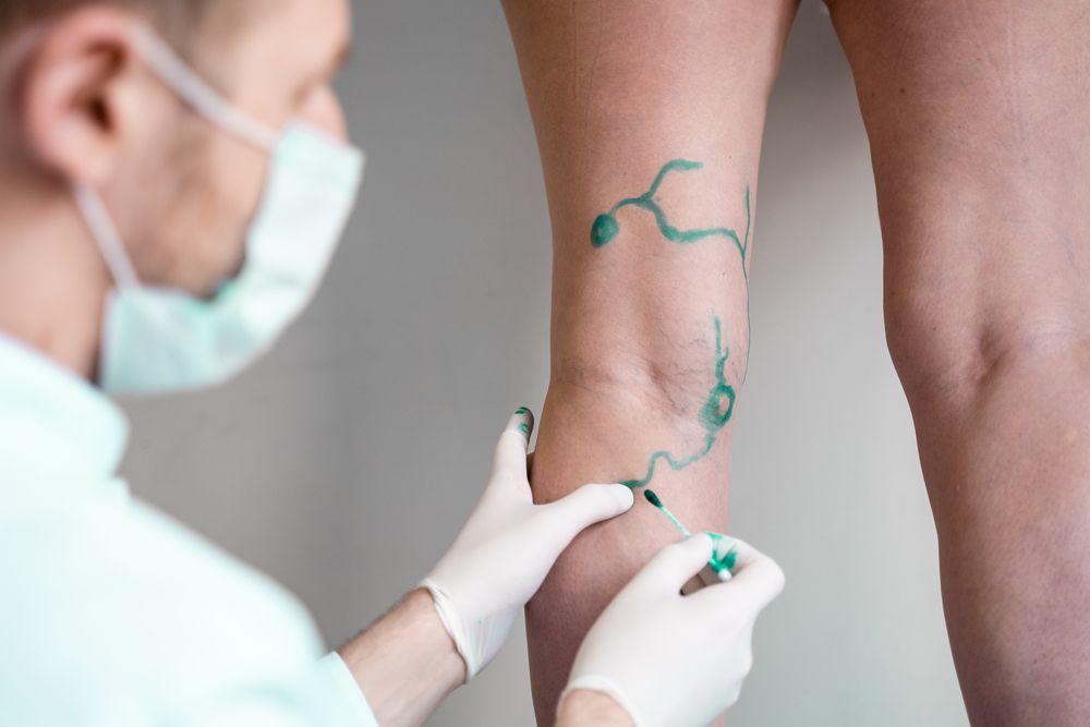 Vascular Surgery: A Comprehensive Guide for Patients