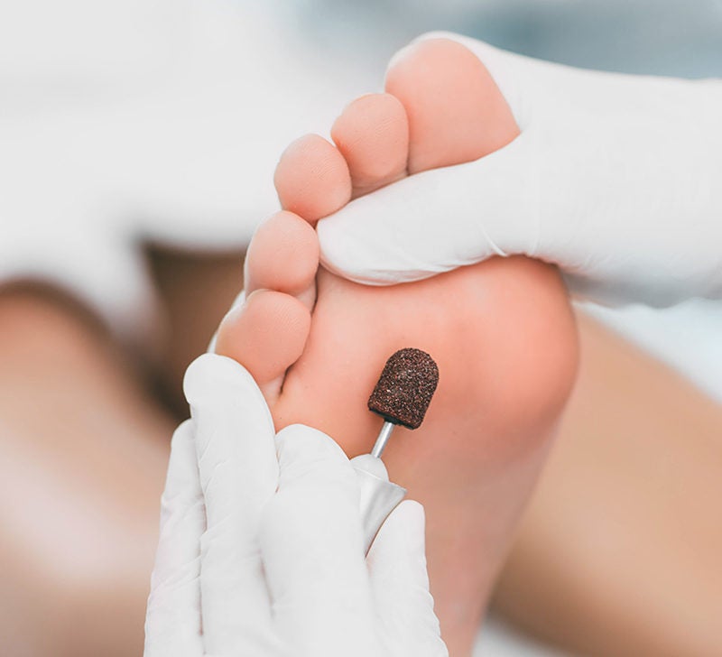 How Podiatrists Aid In Arthritis Treatment