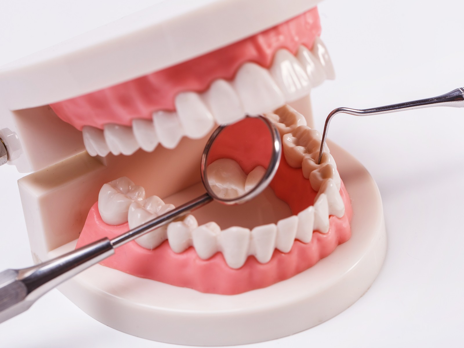 Essential Things to Know Before Getting a Dental Crown