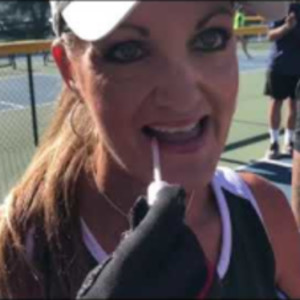 Meet The Pickleball PLAYERS At Surprise City Courts In Arizona 2019