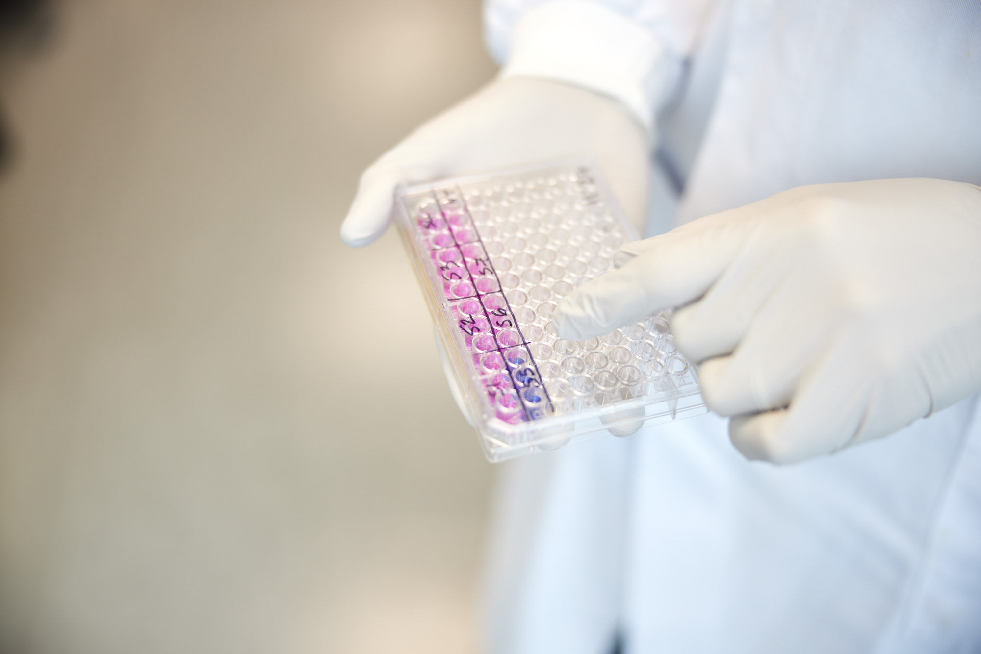 Autolus Therapeutics cover image