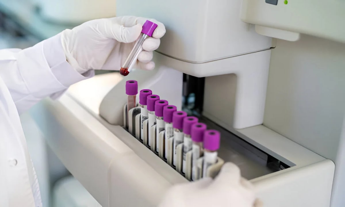 Advanced blood testing laboratory at Henotic Diagnostics