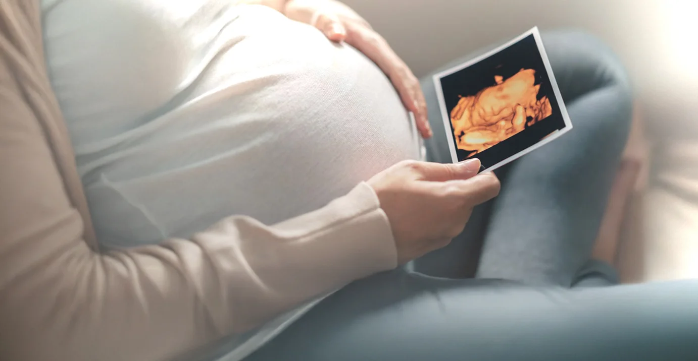 Expectant mother holding an ultrasound scan