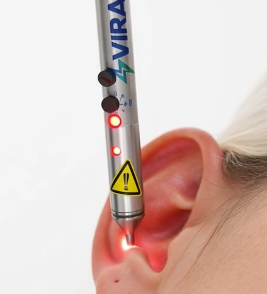 Laser VIRAA® appliqué sur l'oreille