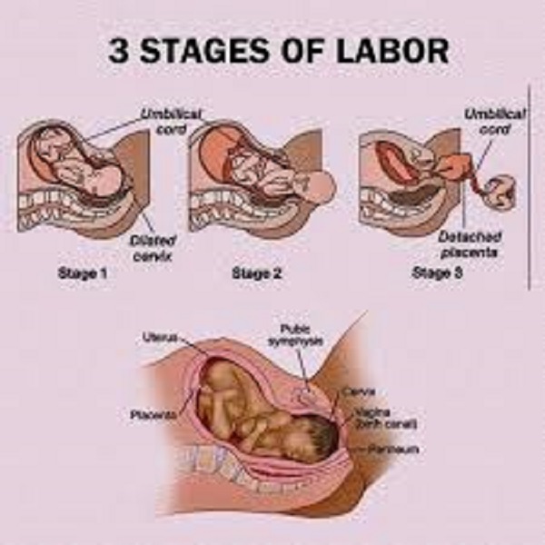 Diagram showing the stages of labour