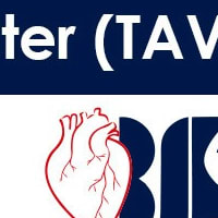 Implante de Válvula Aórtica Transcateter (TAVI) no Hospital do Coração Bom Jesus 