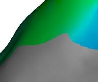 Ablação por Radiofrequência com Mapeamento Eletroanatômico