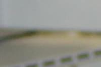 Ablação por Radiofrequência com Mapeamento Eletroanatômico