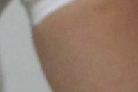 Dia Nacional de Atenção à Disfagia