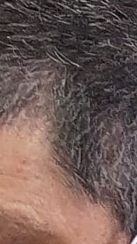 Semana de Humanização