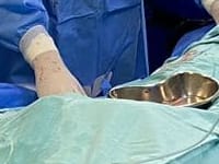 Novo recorde do setor de Hemodinâmica! 