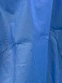 Novo recorde do setor de Hemodinâmica! 