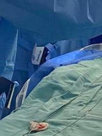 Novo recorde do setor de Hemodinâmica! 