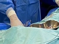 Novo recorde do setor de Hemodinâmica! 