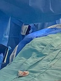 Novo recorde do setor de Hemodinâmica! 