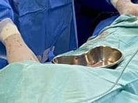 Novo recorde do setor de Hemodinâmica! 