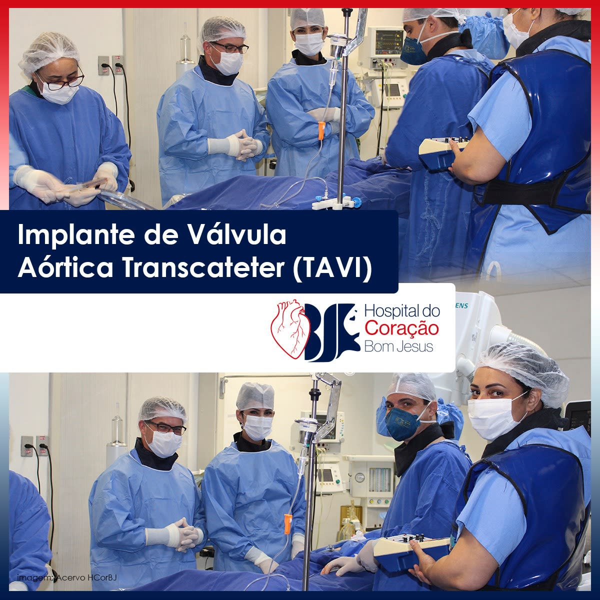 Implante de Válvula Aórtica Transcateter (TAVI) no Hospital do Coração Bom Jesus 