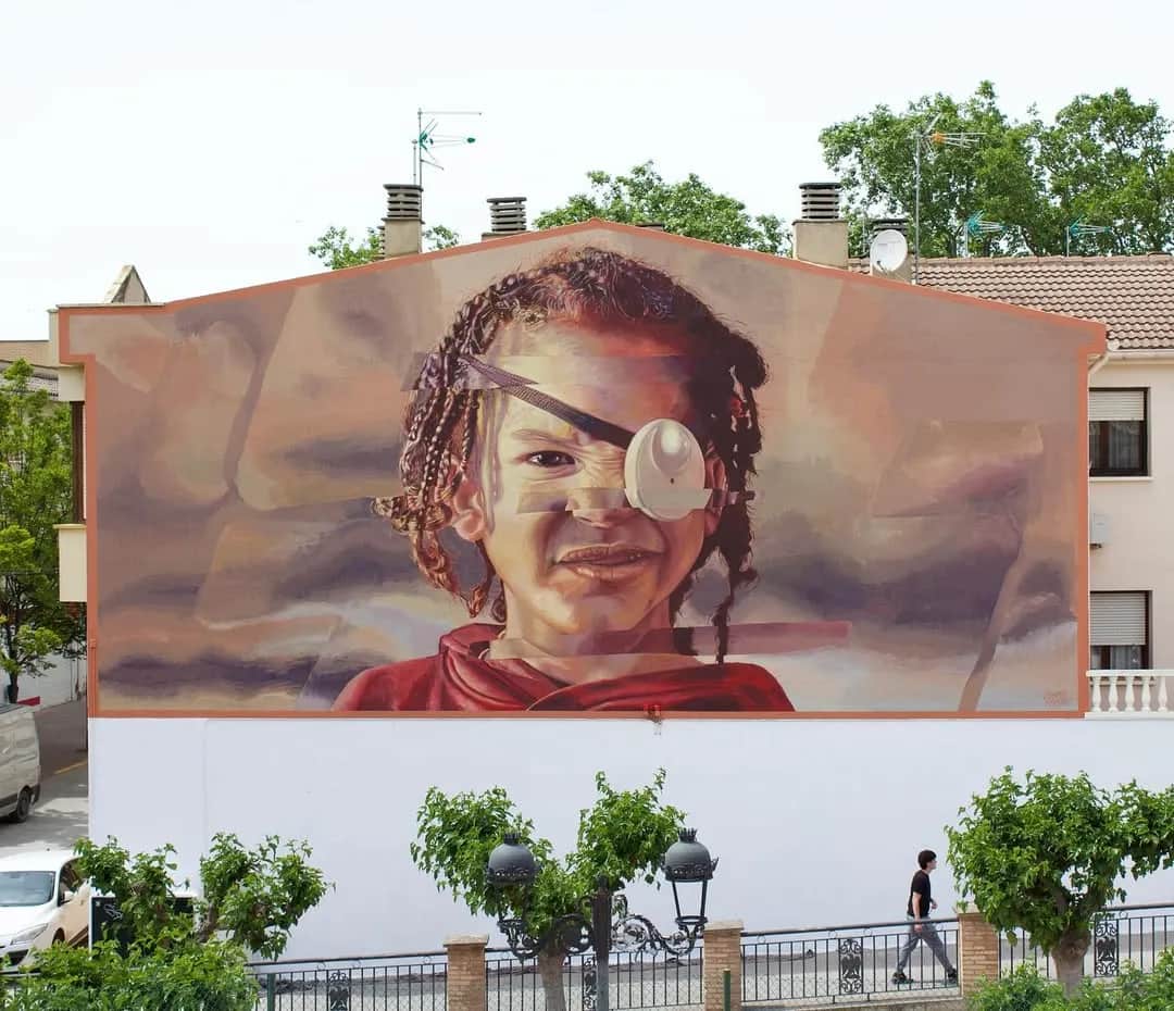 Mural de una niña con el ojo tapado en un edificio blanco.