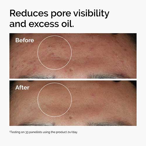 The-Ordinary-Niacinamide-Serum-vanijay3