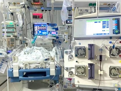 ​Тюменские врачи провели уникальную процедуру младенцу с критически низкой массой тела