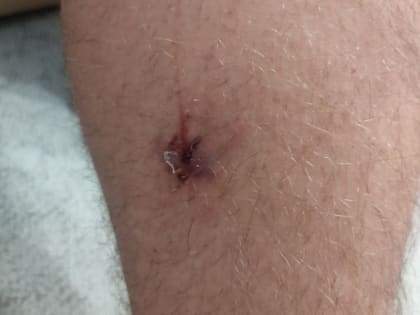 В поселке ХМАО собака на самовыгуле терроризирует людей