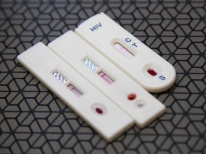 Роспотребнадзор ХМАО заподозрили в сокрытии данных статистики по ВИЧ