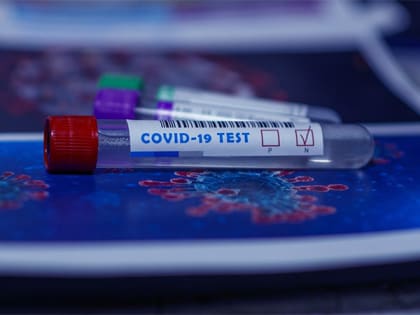 29 случаев заражения COVID-19 выявили в Ханты-Мансийске за сутки