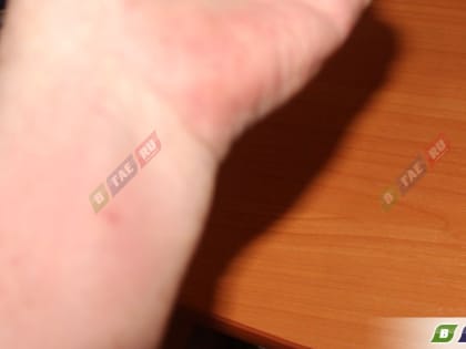 Оказывается, мошку притягивают оранжевые штаны