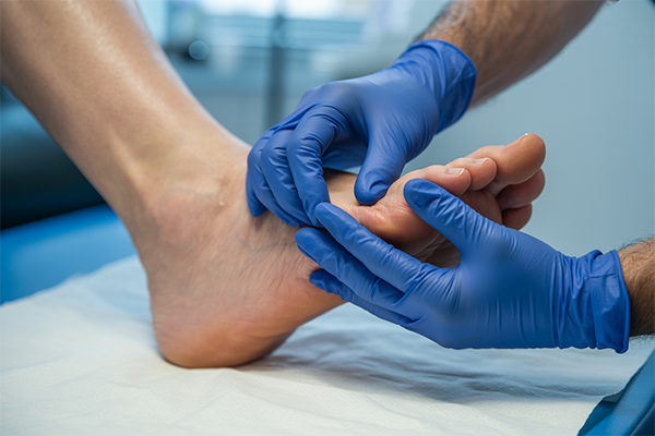 West Haven Tips for Choosing the Right Shoes for Bunions